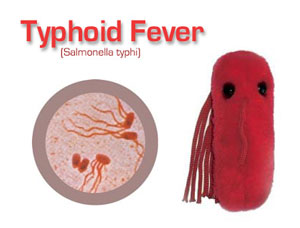 typhoid